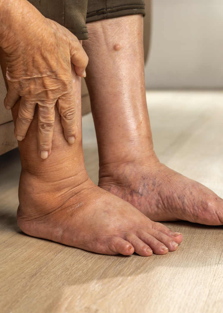 Our Services diabetic foot conditions Our Services diabetic foot conditions